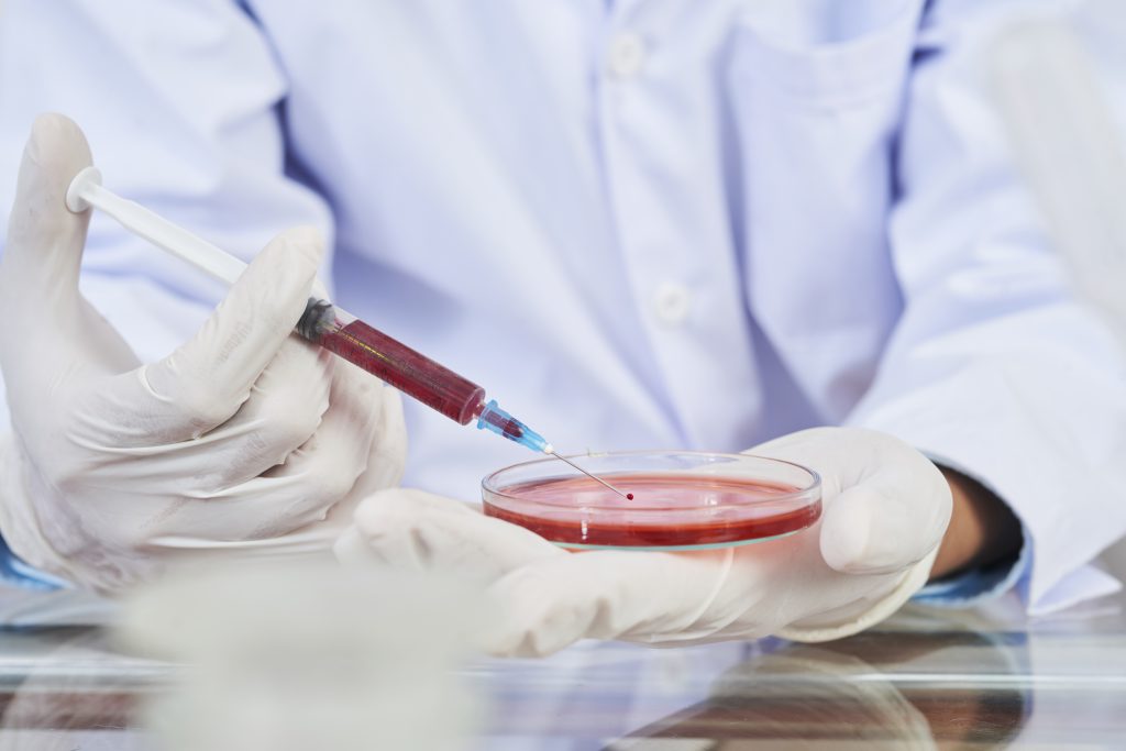 Laboratory worker filling Petri dish with red reagent